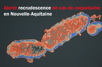 Alerte Coqueluche