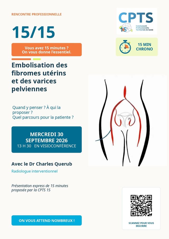 L’embolisation des fibromes utérins et des varices pelviennes par le Dr Charles Querub